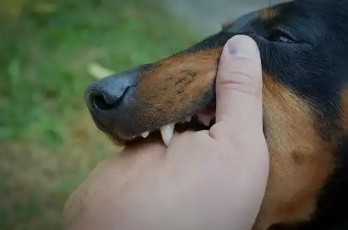 Dog Bites